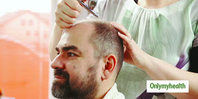 Hair Patch Treatment Process Hair Care Tips In Hindi 